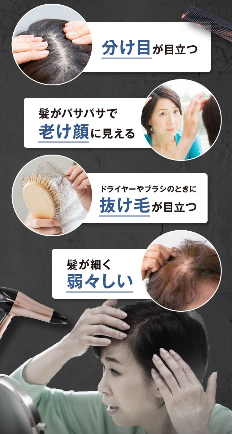 分け目 老け顔 抜け毛 弱々しい