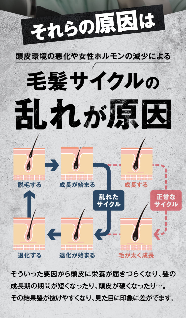 それらの原因は毛髪サイクルの乱れが原因