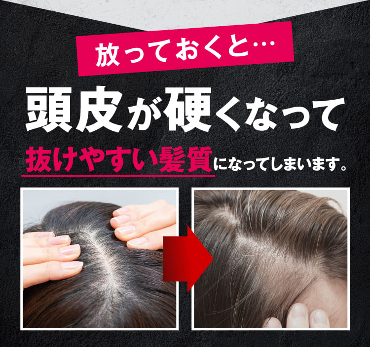 頭皮が硬くなって抜けやすい髪質になってしまいます。